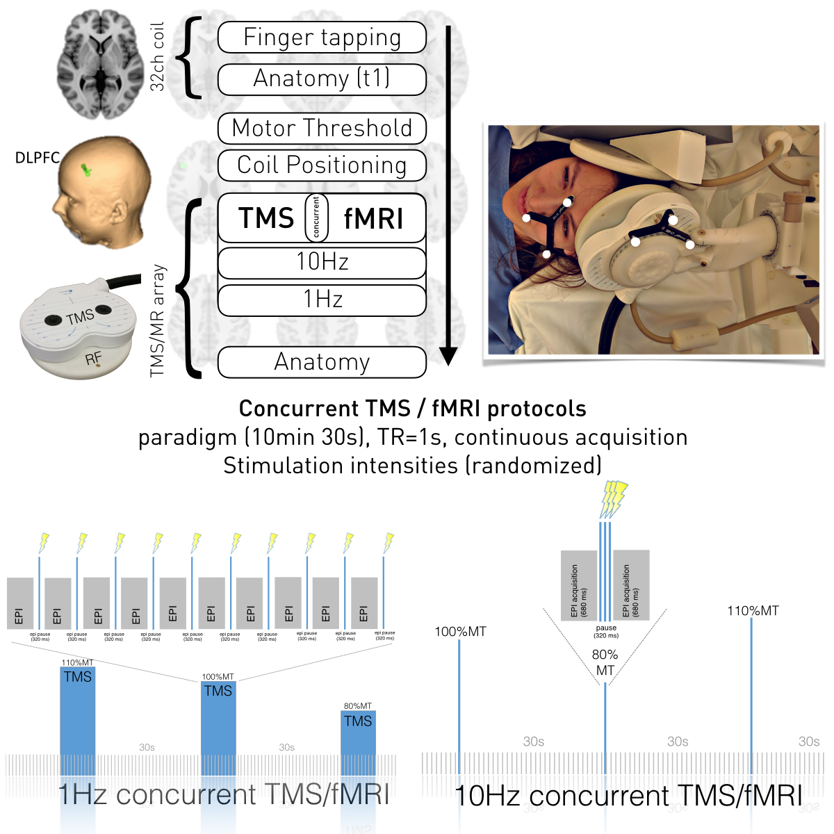 TMS Archives » fmri.at neuroimaging & stimulation
